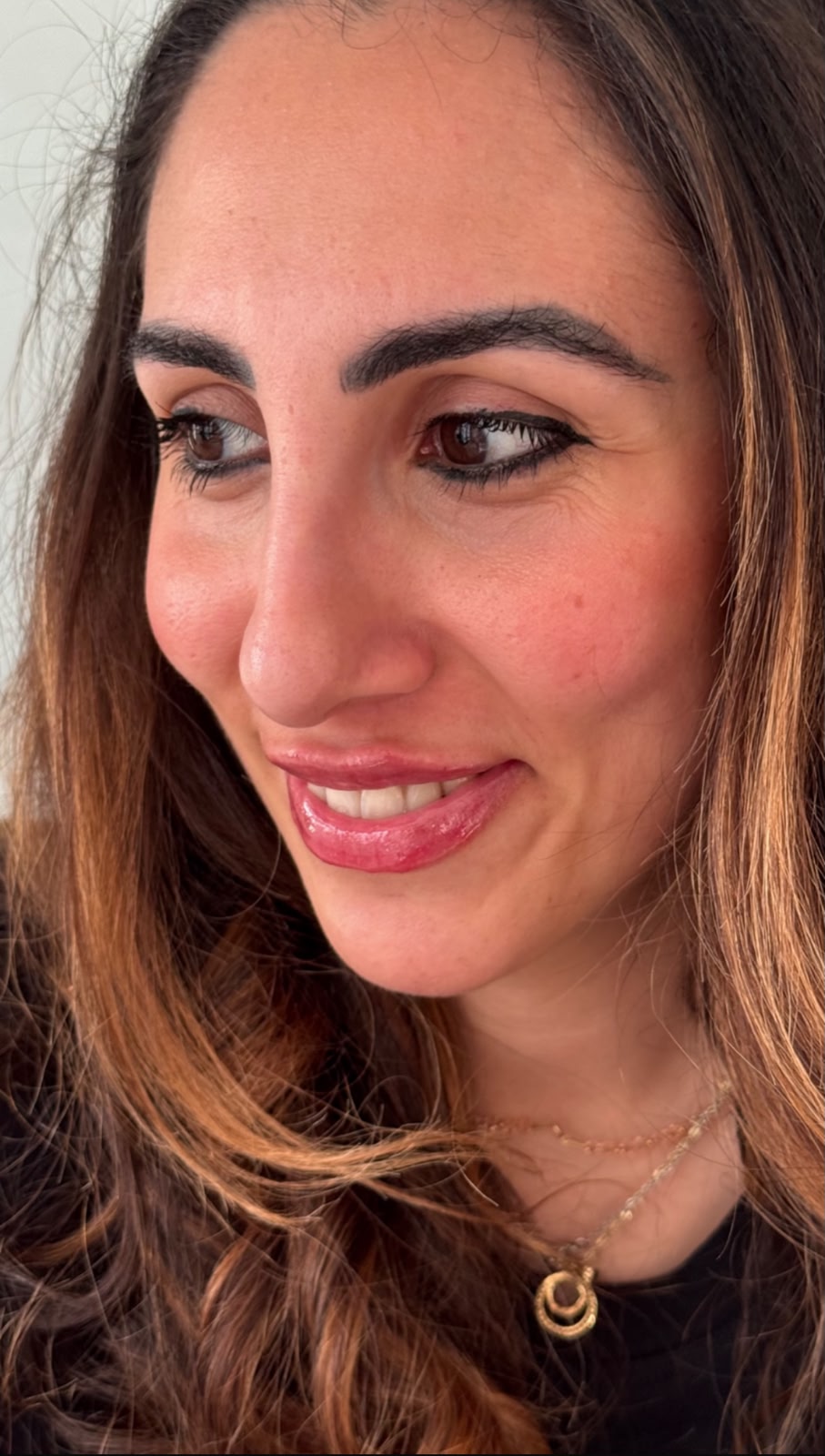 Risultato dopo l'intervento